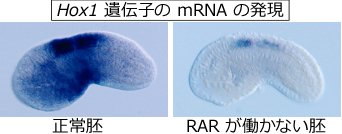RAR �ɂ�� Hox1 ��`�q�̓]�ʊ�����