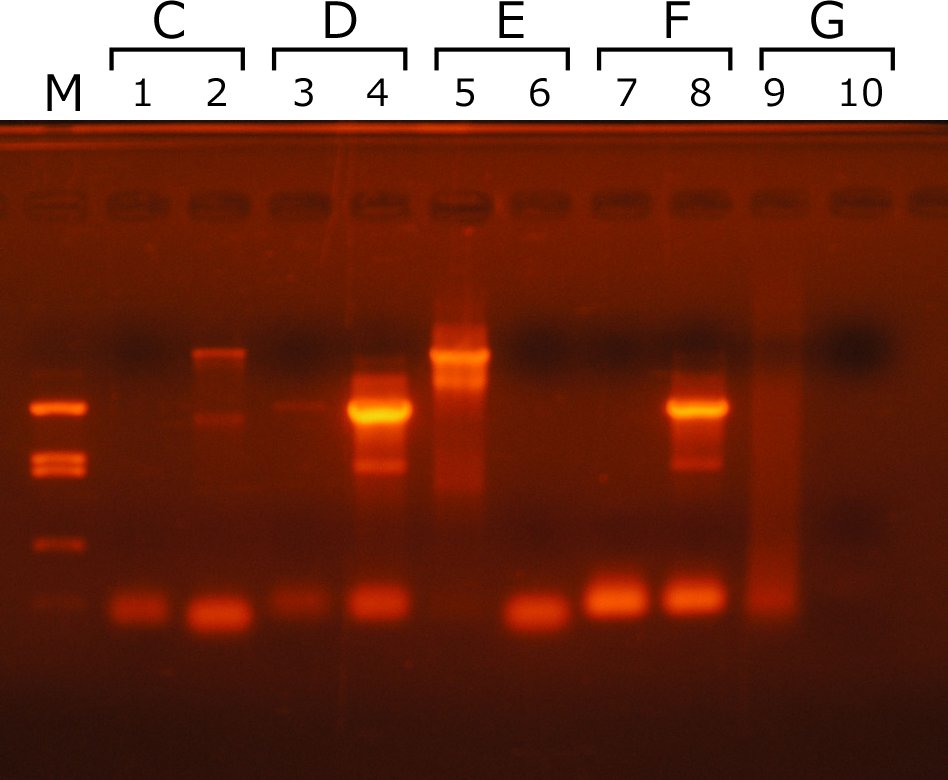 練習問題の PCR の結果