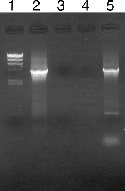 練習問題の PCR の結果